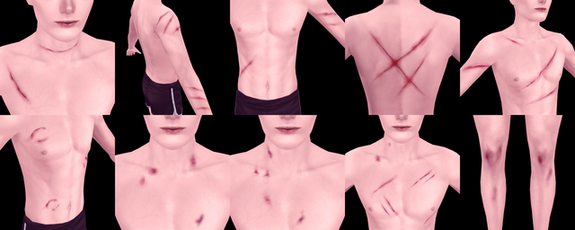 Random-Body-Bruises.png